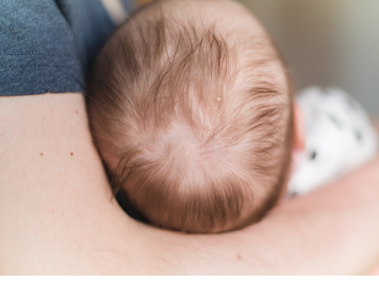 赤ちゃんの頭皮が乾燥する理由と対処法│3児子育て経験から徹底解説