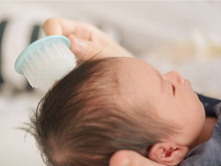 赤ちゃんの頭皮が乾燥する理由と対処法 3児子育て経験から徹底解説