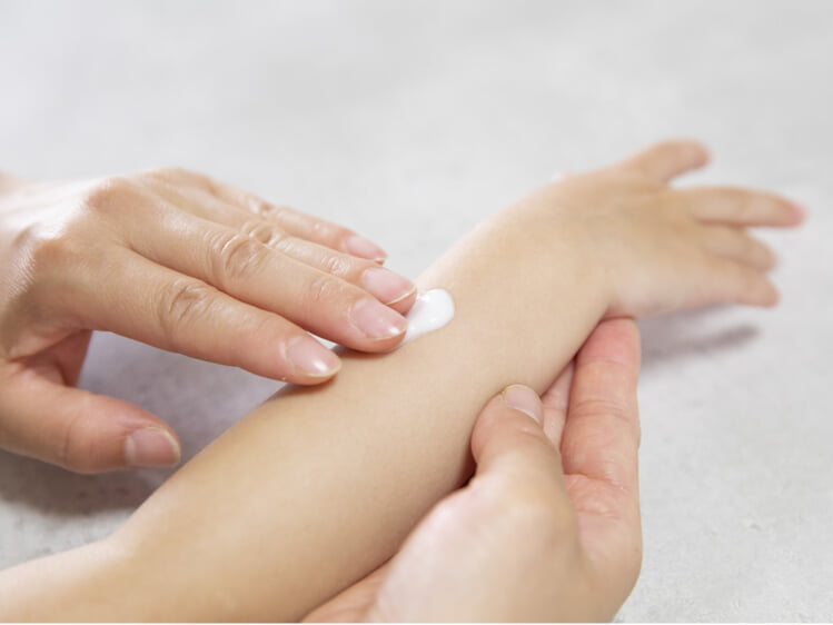 子供の肌荒れ対処法・ステロイドやワセリン、クリームの違いを紹介 健康肌スキンケア