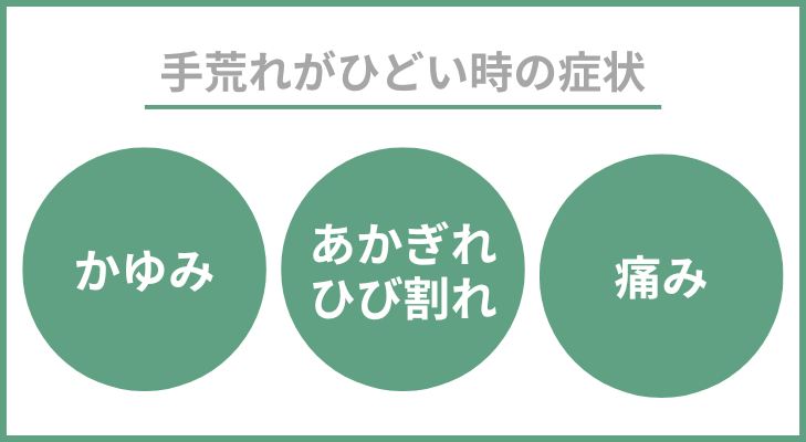 “手荒れがひどい時の症状”
・かゆみ
・あかぎれ/ひび割れ
・痛み