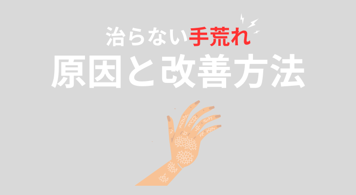 手荒れが治らない原因と改善方法