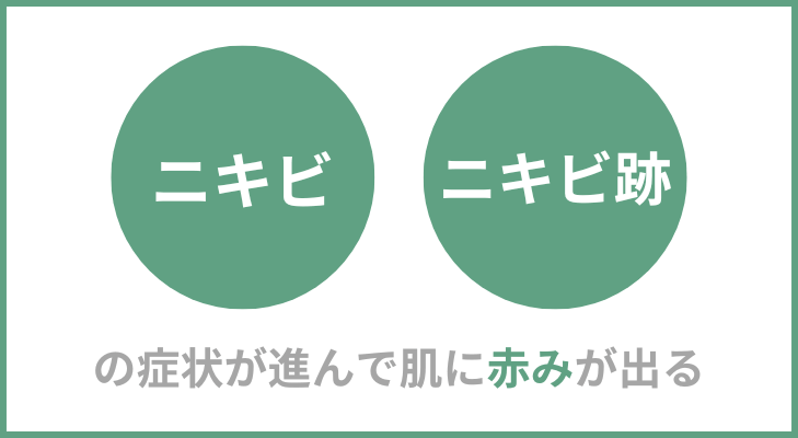 ニキビ・ニキビ跡が肌の赤みの原因になっている場合