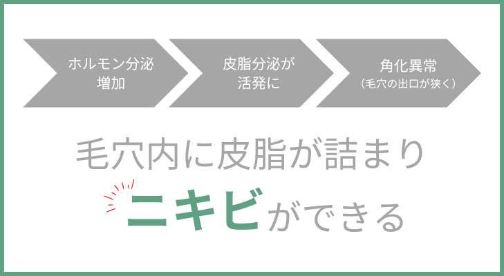 毛穴内に皮脂が詰まりニキビができる