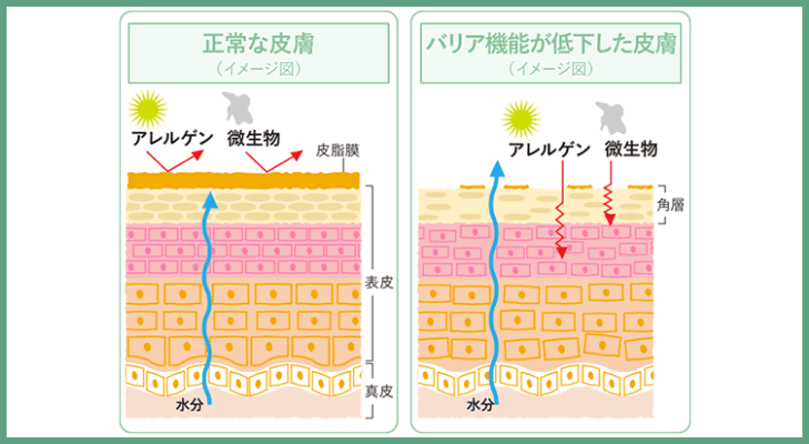 正常な肌と、バリア機能が低下した肌の比較