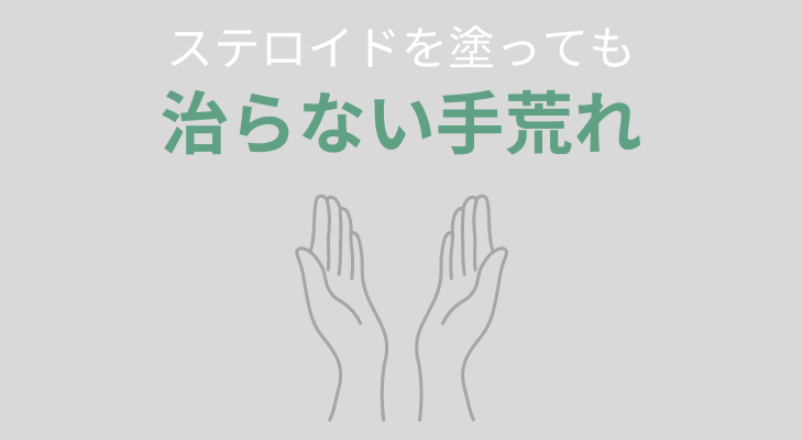 ステロイドを塗っても治らない手荒れ