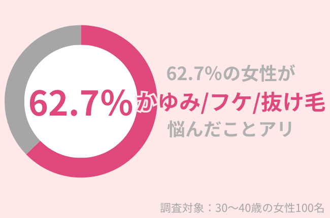 62.7％の30代女性がかゆみ・フケ・抜け毛に悩んだことがある