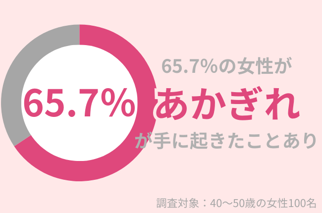 65.7％の40代女性があかぎれが手にできたことがある